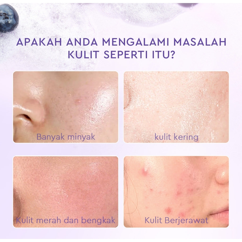 [Big Size]Glad2Glow Blueberry Ceramide Low pH Gel Cleanser 150ml facial wash skincare face wash sabun cuci muka cleansing balm exfoliating exfoliasi wajah sabun muka pembersih wajah Memperbaiki penghalang kulit tetap terhidrasi wajah bersih