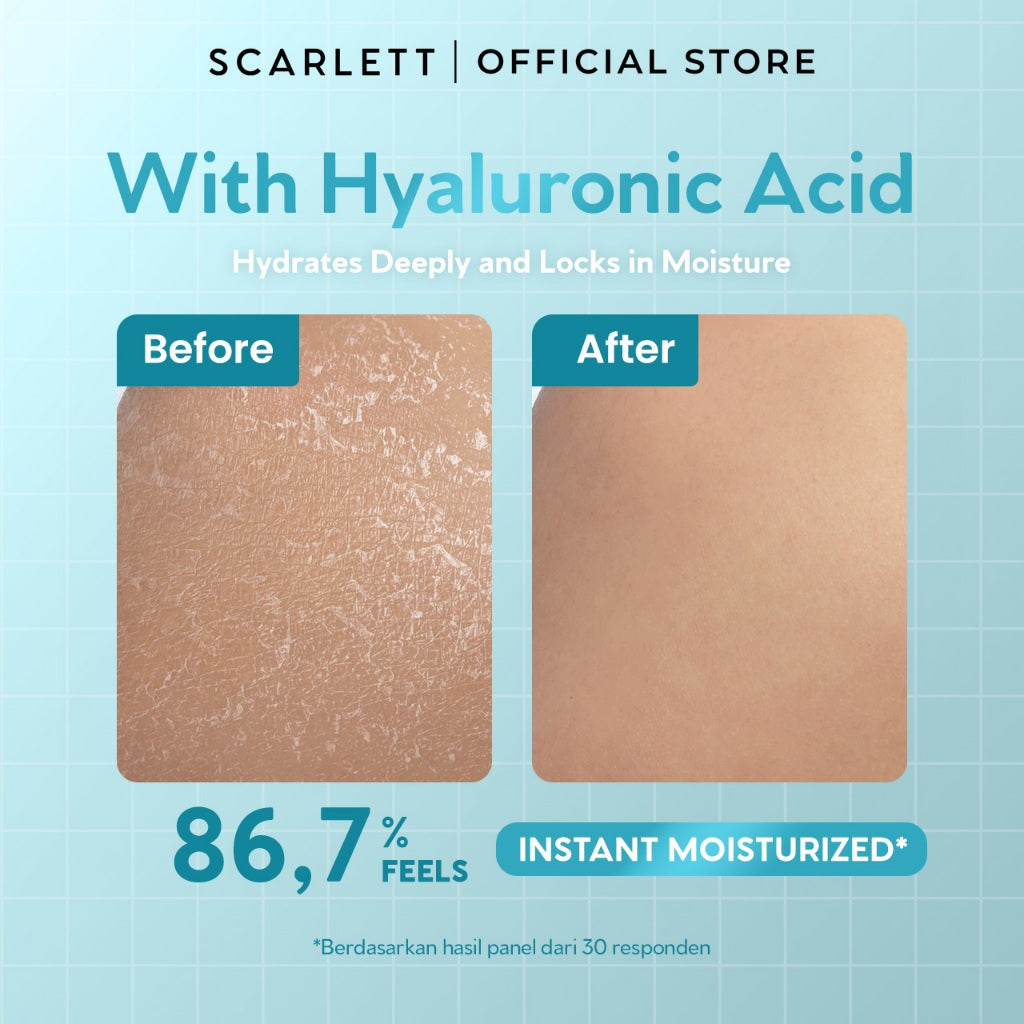 SCARLETT Perfumed Shower Serum 400ml – Hydra Burst | Hydrating Shower Gel dengan Hyacross™ | Sabun Mandi Cair Melembabkan Kulit Kering, Menjaga Kelembapan | Kulit Lembut & Kenyal dengan Wangi Parfum Mewah Kelas Dunia
