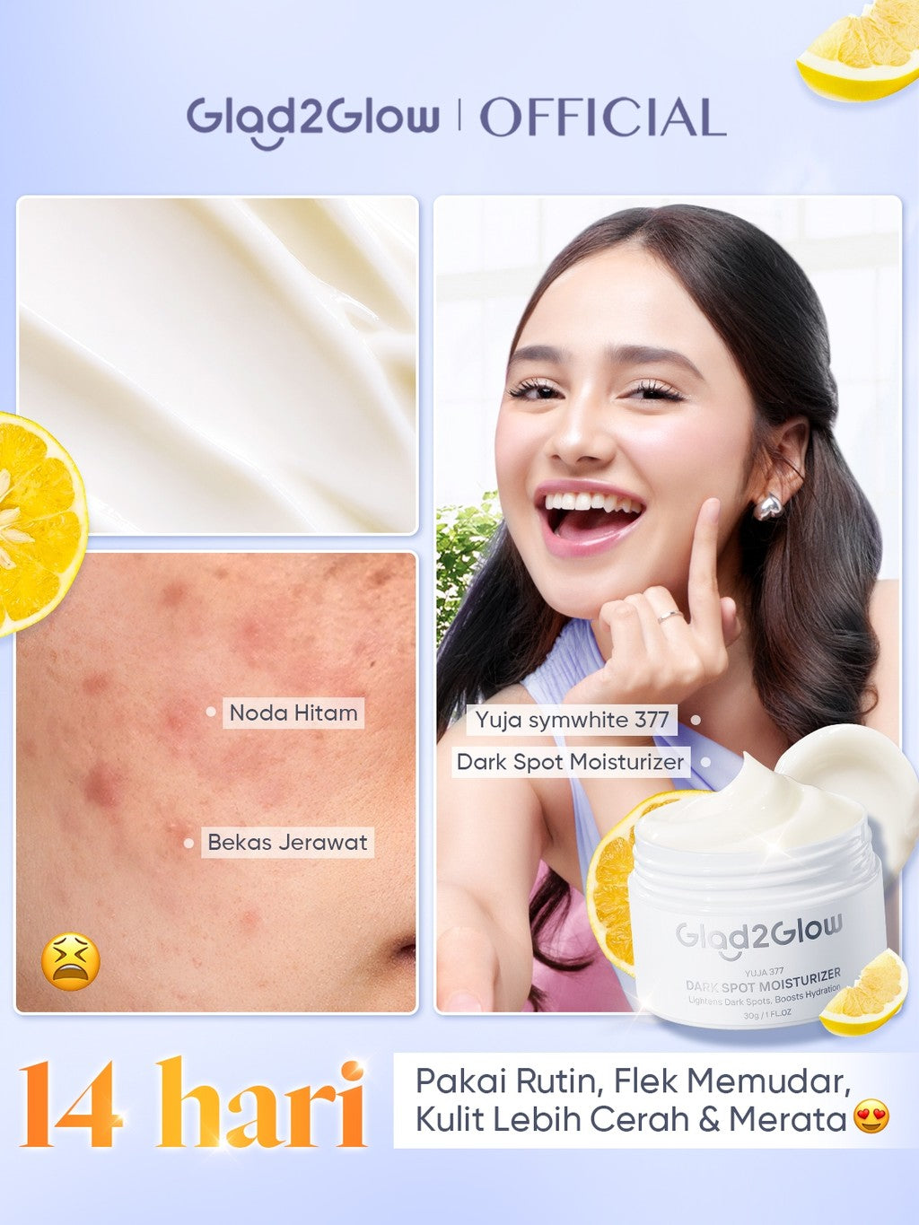 [SPOT-LIGHTENING] Glad2Glow 377 Dark Spot Concealer  bundle 4PCS Skincare Paket-SymWhite 377 Moisturizer+ 377 Serum+Cleanser +Niacinamide Day Cream Memperbaiki warna kulit kusam dan mencerahkan kulit G2G g2g officialstore