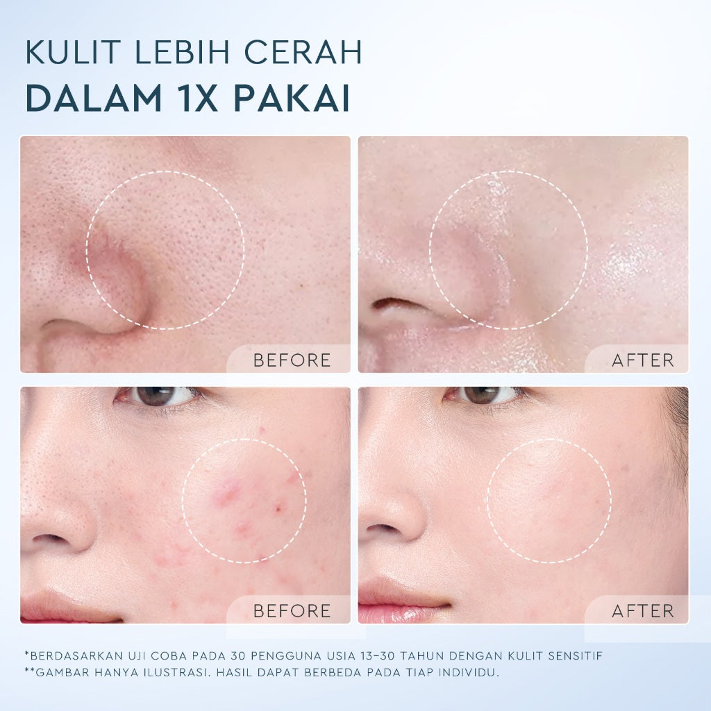 [NEW]Glad2glow Volcanic Ash+BHA Deep Pore Clean Facial Cleanser Mencegah Komedo Face Wash g2g