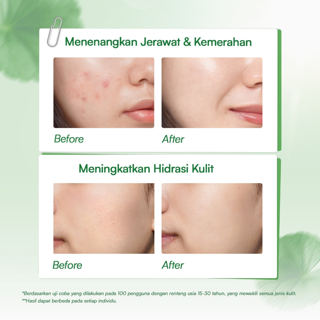 Glowsophy Bundle 2in1 Calm and Bright Hydration - Moisturizer CICA Centella Soothing Moisturizer 100 ml + Watermelon Brightening Moisturizer Niacinamide 100 ml