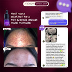 Lacoco Dark Spot Essence Serum Penyamar Flek Hitam Noda Bekas Jerawat Tranexamic Acid Finally Something Glad True Skint