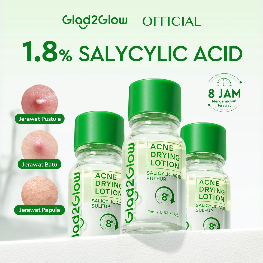 GLAD2GLOW Acne Drying Lotion Mengeringkan Jerawat 8 Jam Dengan Sulfur BHA & Bahan Alami Instant Acne Care Acne Gel Patch Spot Jerawat Serum Moisturizer Acne Skincare Wajah face wash facial Salicylic Acid Niacinamide g2glow official store