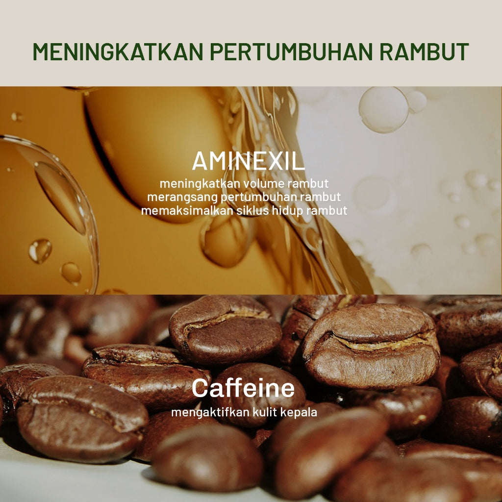 [2IN1 BUNDLE] Lavojoy Hold Me Tight Pro Shampoo + Conditioner Series | Perawatan Rambut Rontok| Rambut Lepek | Anti Ketombe | Lembut Bervolume | Rambut Halus | Mengurangi Rambut Berminyak | Menutrisi Rambut | Mengurangi Gatal Kulit Kepala