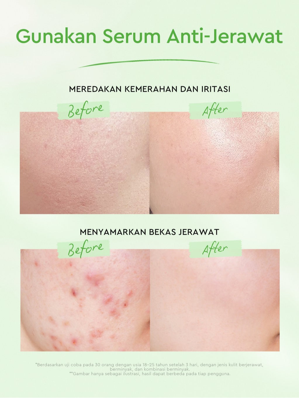 Glad2Glow Centella 2% Salicylic Acid Power Acne Serum skincare serum wajah Eksfoliasi Wajah skincare bpom essence Anti jerawat scincare lembut skincare Menyamarkan bekas jerawat  Menenangkan kulit berjerawat Merawat kulit berjerawat g2glow official store