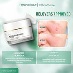 Personal Beauty Acne Soothing Cream - Soothing And Calming