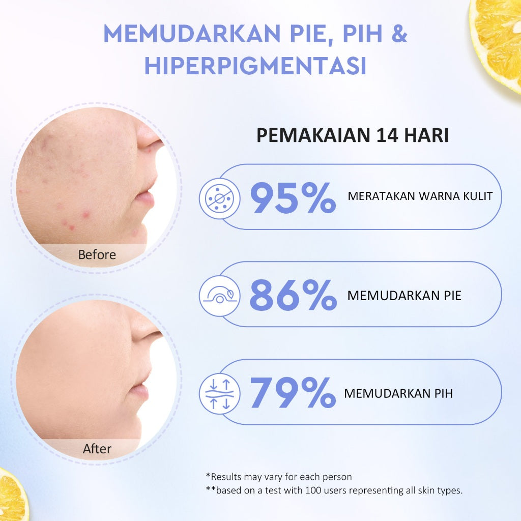 [BIG MOIST]Glad2Glow Yuja Symwhite 377 Dark Spot Moisturizer 100g menghilangkan bekas jerawat brightening night cream day cream Hilangkan Flek & Tenangkan Kulit Skincare Pelembab Esensi Wajah Perawatan Kulit Pelembab Wajah Pembersih day cream tone up g2g