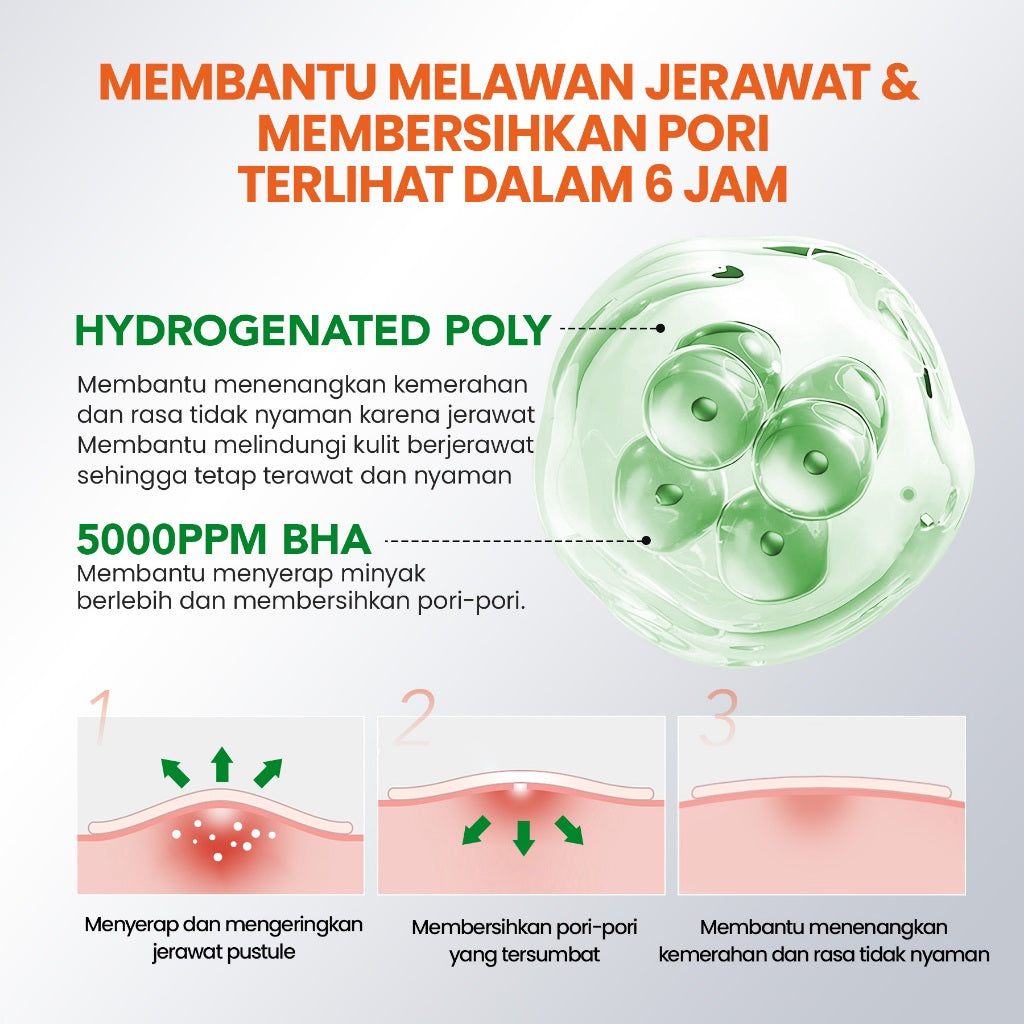 [NEW] YOU AcnePlus BHA Acne Patch Jerawat 5000 ppm Salicylic Acid 36 PCS