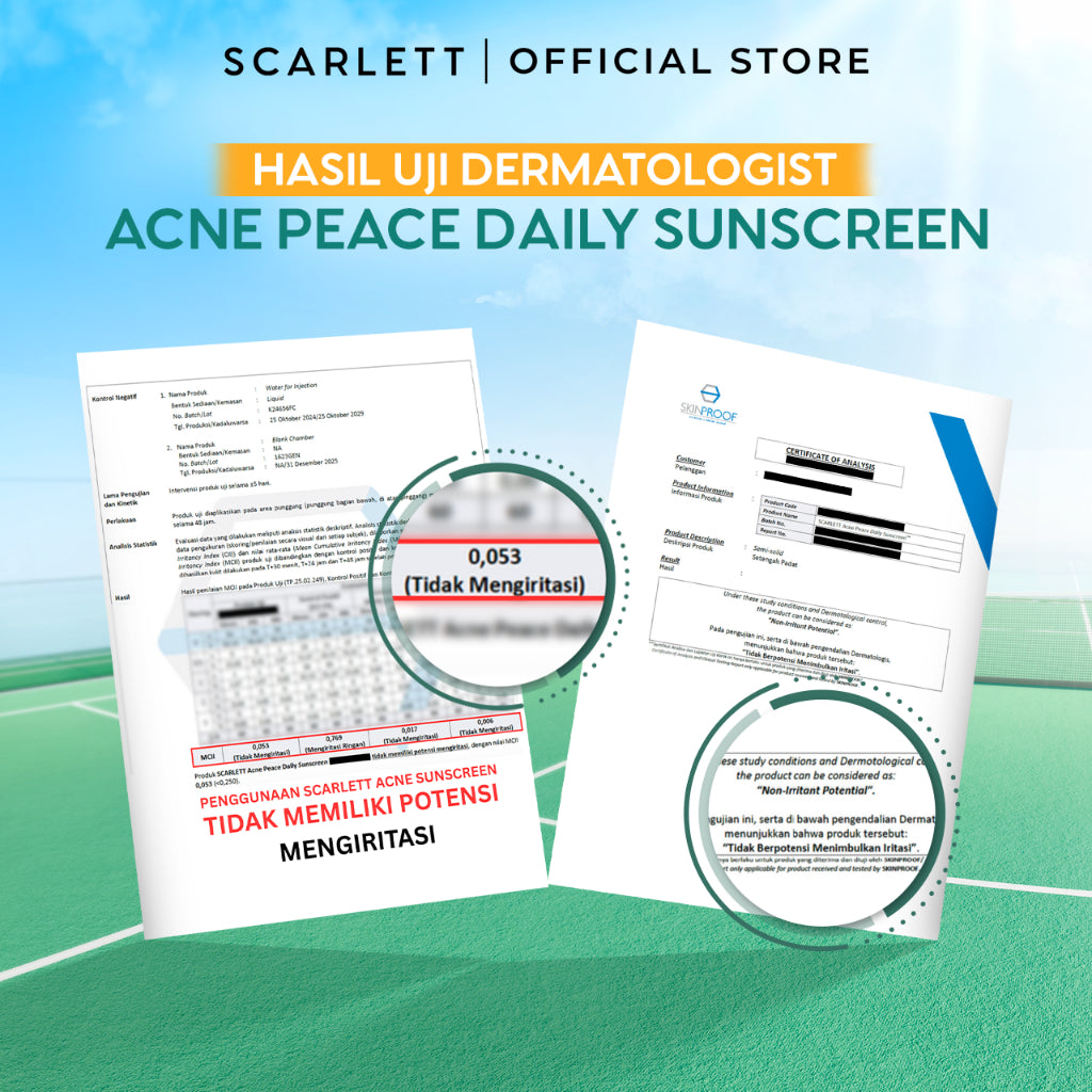 SCARLETT Twinpack Acne Peace Daily Sunscreen SPF 35 PA++++ – Sunscreen Kulit Berjerawat , Teruji In Vivo , Non Acnegenic Tested , Non Comedogenic Tested, Melawan Jerawat