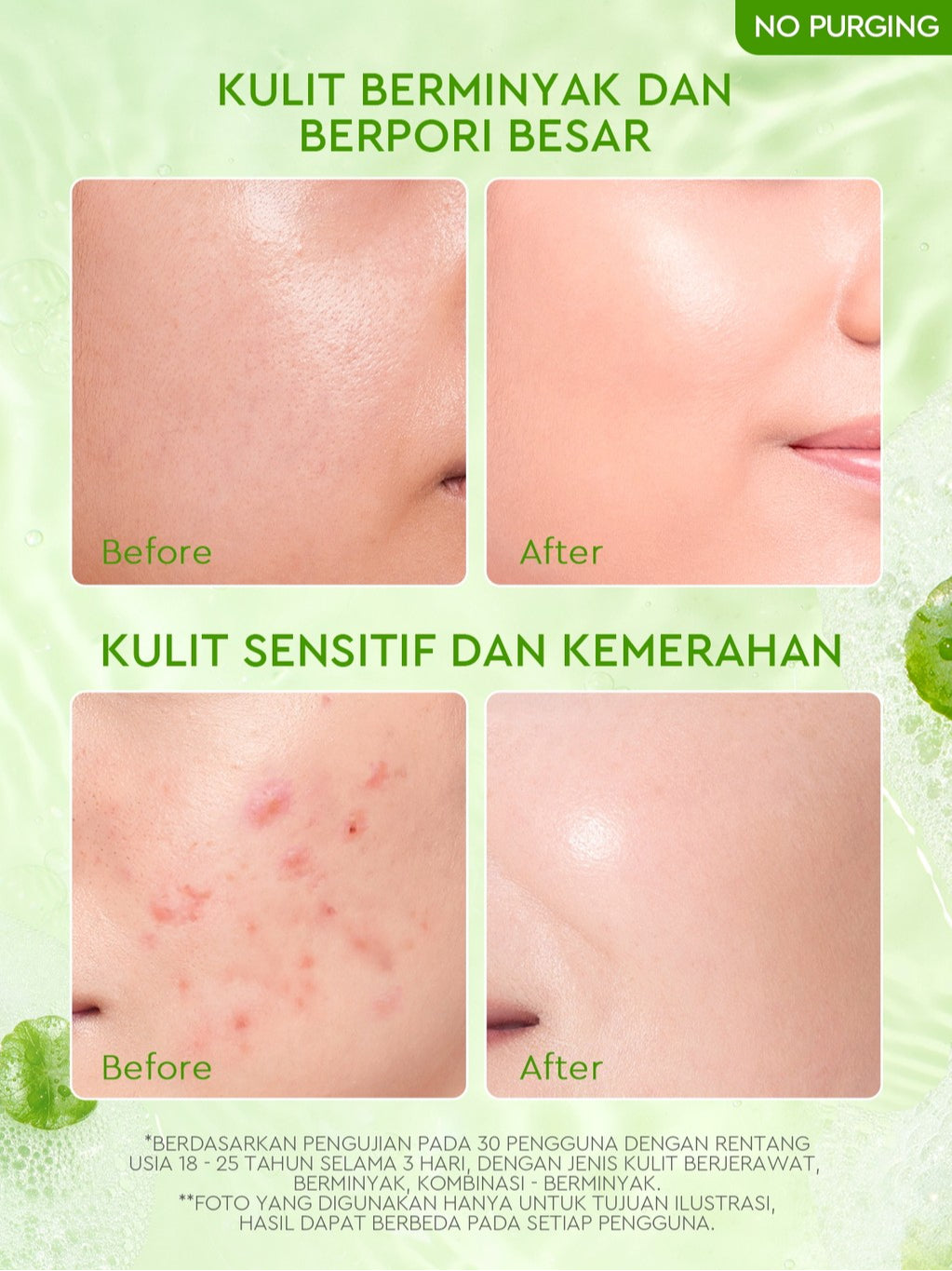 Glad2Glow Centella Salicylic Acid Acne Gel Cleanser  facial wash skincare face wash sabun cuci muka cleansing balm exfoliating exfoliasi wajah sabun muka pembersih wajah merawat serta membantu menenangkan jerawat g2glow official store