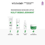 Whitelab 4 pcs Paket Acne - Facial Wash, Toner, Serum, Moisturizer Paket Skincare