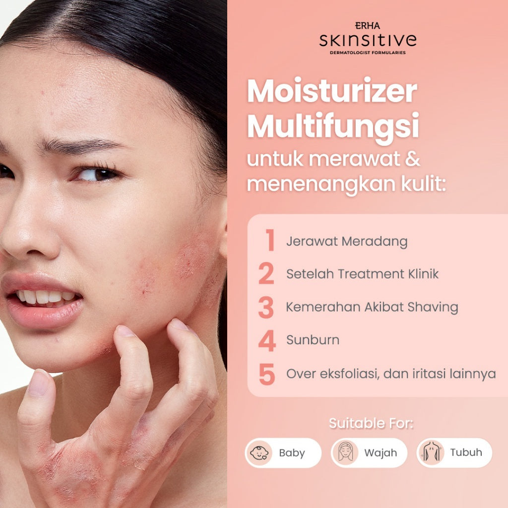ERHA Skinsitive UltracalmPRO Multipurpose Calming Cream 100gr | Krim Multifungsi Untuk Semua Jenis Kulit (Normal, Kering, Sensitif, Iritasi) | Meredakan Gatal dan Kemerahan, Sunburn | Meredakan Eksim | Mencegah Stretchmark | Aman untuk Anak 3+