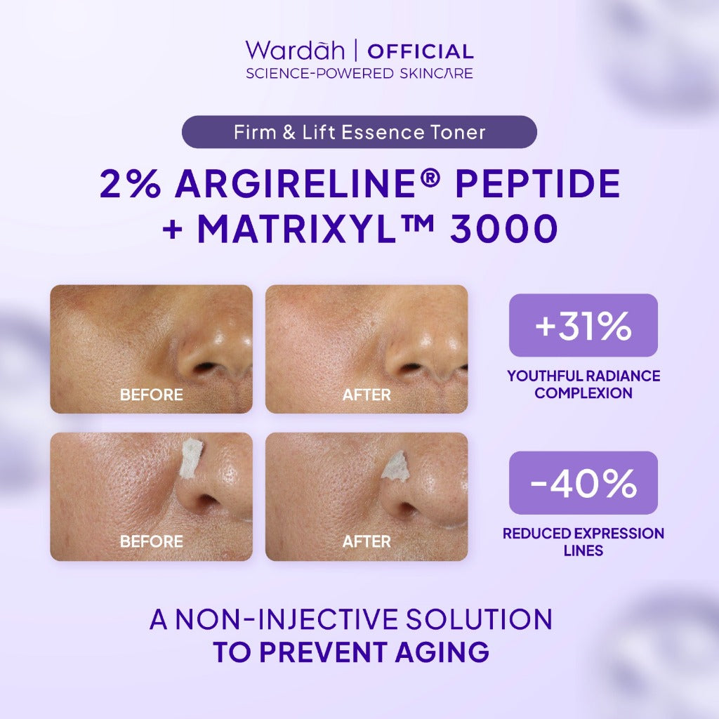 NEW! Wardah 2% Argireline Peptide MatrixylTM 3000 Firm & Lift Essence Toner 100 ml - Mencegah Penuaan Dini, Mengencangkan Kulit, Mengurangi Smile Line, dan Meningkatkan Elastisitas Kulit - Untuk Semua Jenis Kulit - Skincare