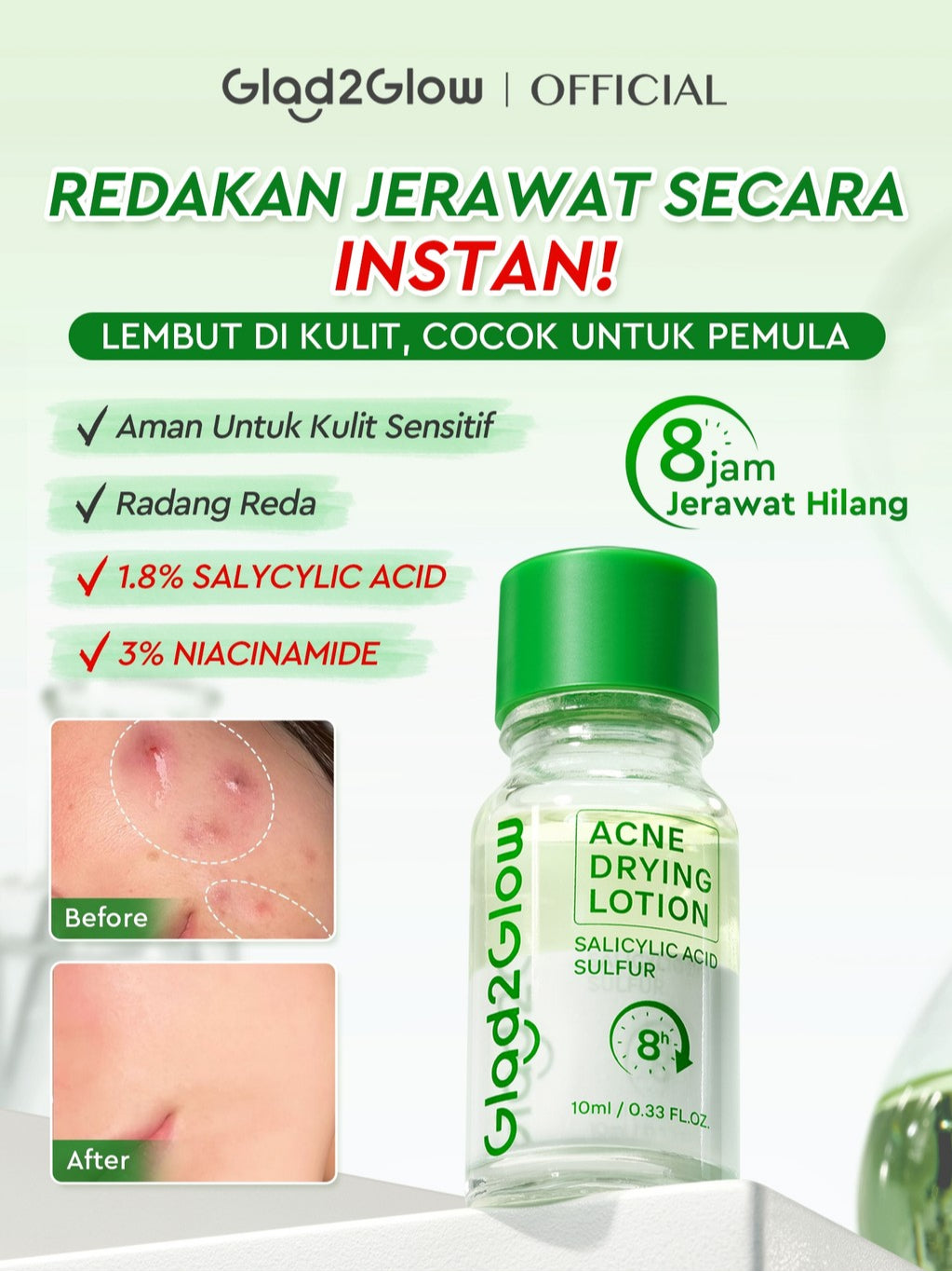 GLAD2GLOW Acne Drying Lotion Mengeringkan Jerawat 8 Jam Dengan Sulfur BHA & Bahan Alami Instant Acne Care Acne Gel Patch Spot Jerawat Serum Moisturizer Acne Skincare Wajah face wash facial Salicylic Acid Niacinamide g2glow official store