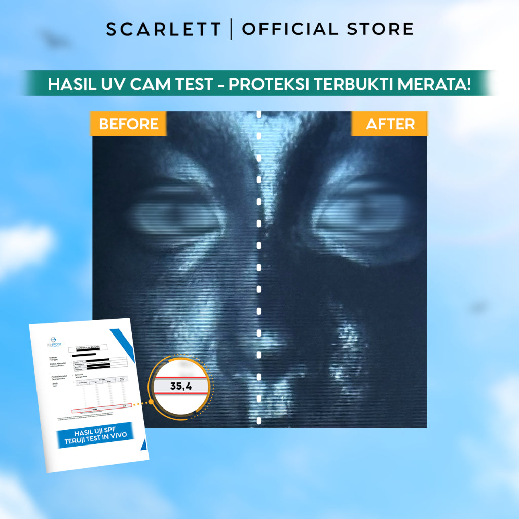 SCARLETT Acne Peace Daily Sunscreen SPF 35 PA++++ – Sunscreen Kulit Berjerawat , Teruji In Vivo , Non Acnegenic Tested , Non Comedogenic Tested, Melawan Jerawat