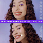Closeup White Now Purple Pasta Gigi Pemutih 95 g