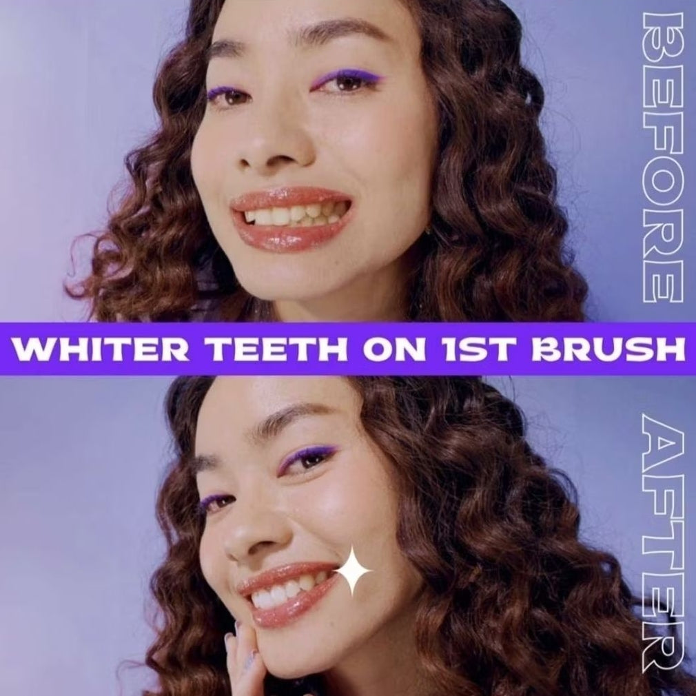 Closeup White Now Purple Pasta Gigi Pemutih 95 g