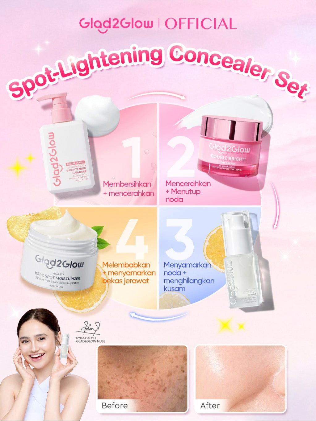[SPOT-LIGHTENING] Glad2Glow 377 Dark Spot Concealer  bundle 4PCS Skincare Paket-SymWhite 377 Moisturizer+ 377 Serum+Cleanser +Niacinamide Day Cream Memperbaiki warna kulit kusam dan mencerahkan kulit G2G g2g officialstore