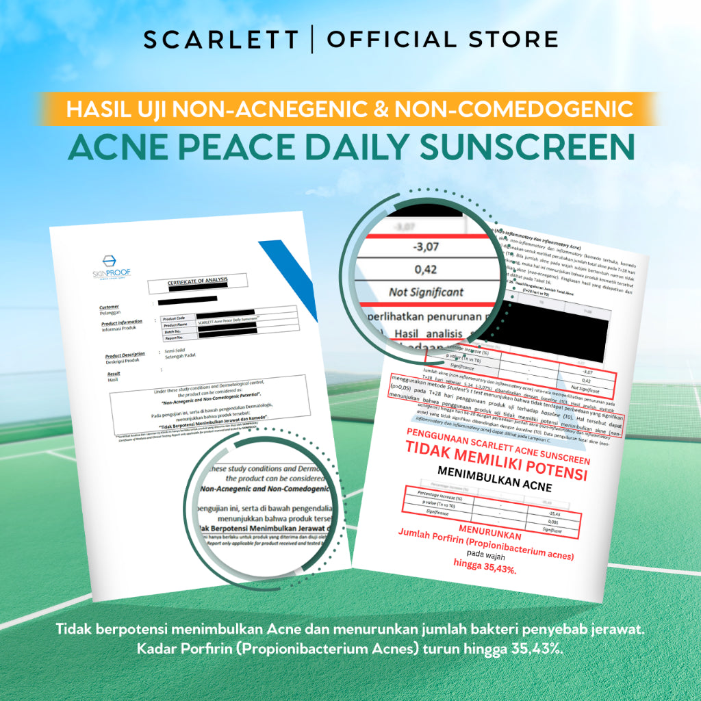 SCARLETT Acne Peace Daily Sunscreen SPF 35 PA++++ – Sunscreen Kulit Berjerawat , Teruji In Vivo , Non Acnegenic Tested , Non Comedogenic Tested, Melawan Jerawat
