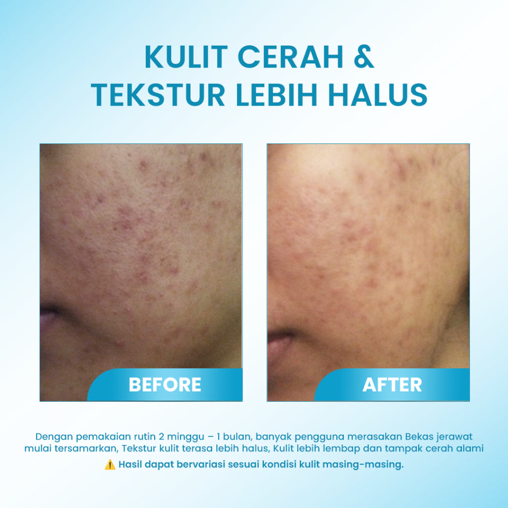 [2IN1 HEMAT] Cleora Bright & Protect - Glow Smooth Moisturizer Dan UV Glow Protect Sunscreen Skincare Pelembab Muka Kering Kusam Mencerahkan Dark Spot Whitening Sunblock Sun Screen Melindungi Dari Sinar Matahari UVA UVB Brightening Day Cream Wanita Pria