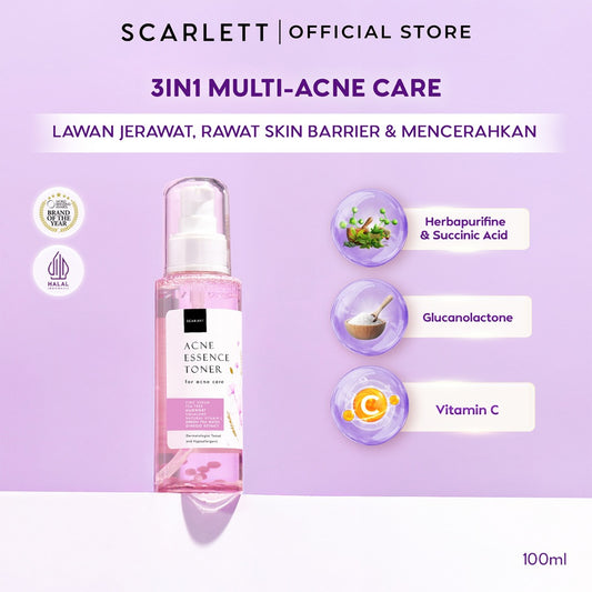 Scarlett Whitening Acne Essence Toner - Toner Ringan Wajah Penghilang & Perawatan Jerawat Ampuh Atasi Hingga Bekasnya with Double Action Salicylic Acid tanpa Bikin Kulit Iritasi