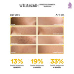 Bundling Whitelab Day Cream & Whitelab Night Cream (New Packaging)
