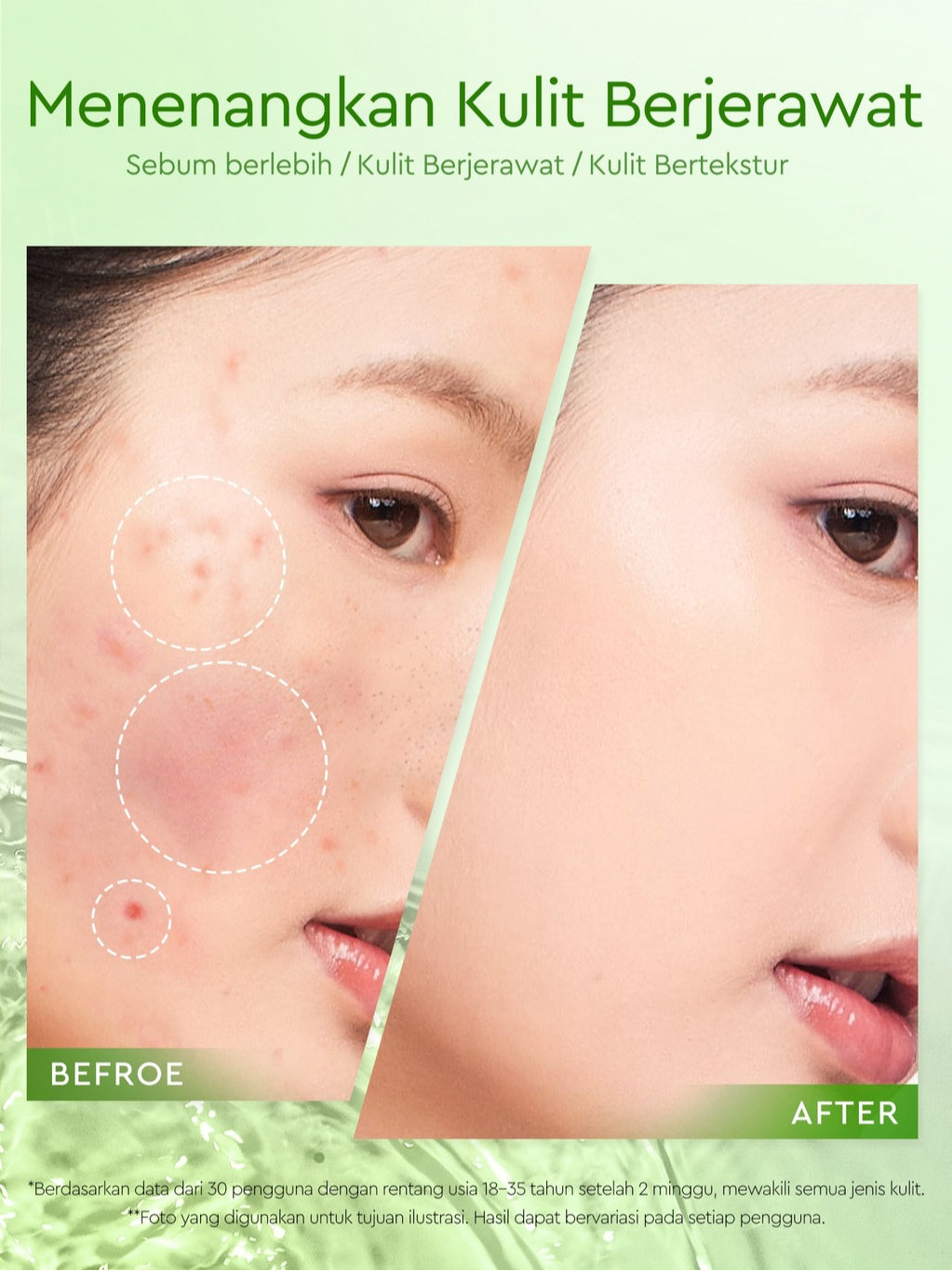 Glad2Glow Mugwort Acne Gel Mask 50g Masker Wajah Masker Komedo dan Pori Pori Wajah Masker Mask Sleeping Mask Sheetmask Clay Masker Jerawat Masker Clay Mask Mugwort Masker Hijau Masker Organik Gel Masker G2G masker wajah mencerahkan G2glow Official