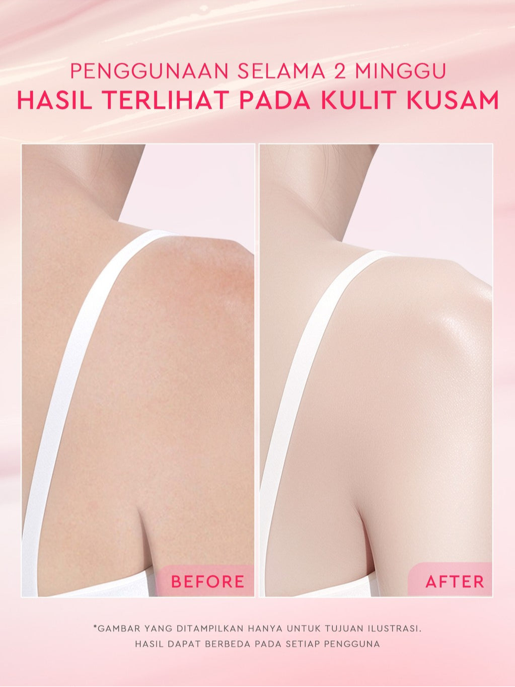 Glad2Glow Bright & Moist Body Serum Series | Body Cream Body Lotion Brighten Moist & Smooth Pemutih Badan Body Serum Glow & Peeling Menghidrasi Kulit Mencerahkan Dan Pemutih Tubuh Atasi Belang Brighty Care Whiten Handbody ohbt Lotion g2g official store