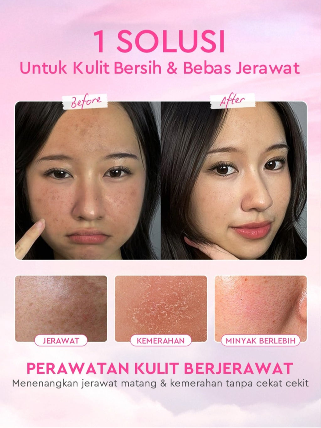 [Cocok Untuk Pemula] Glad2Glow Acne&Cerah Set Glowing  Bundle 4in1-Brightening Moisturizer+Cleanser+Mugwort acne gel mask+10%Niacinamide skincare paket pembersih perawatan kulit mencerahkan warna kulit pelembab wajah all in 1g2glow official store