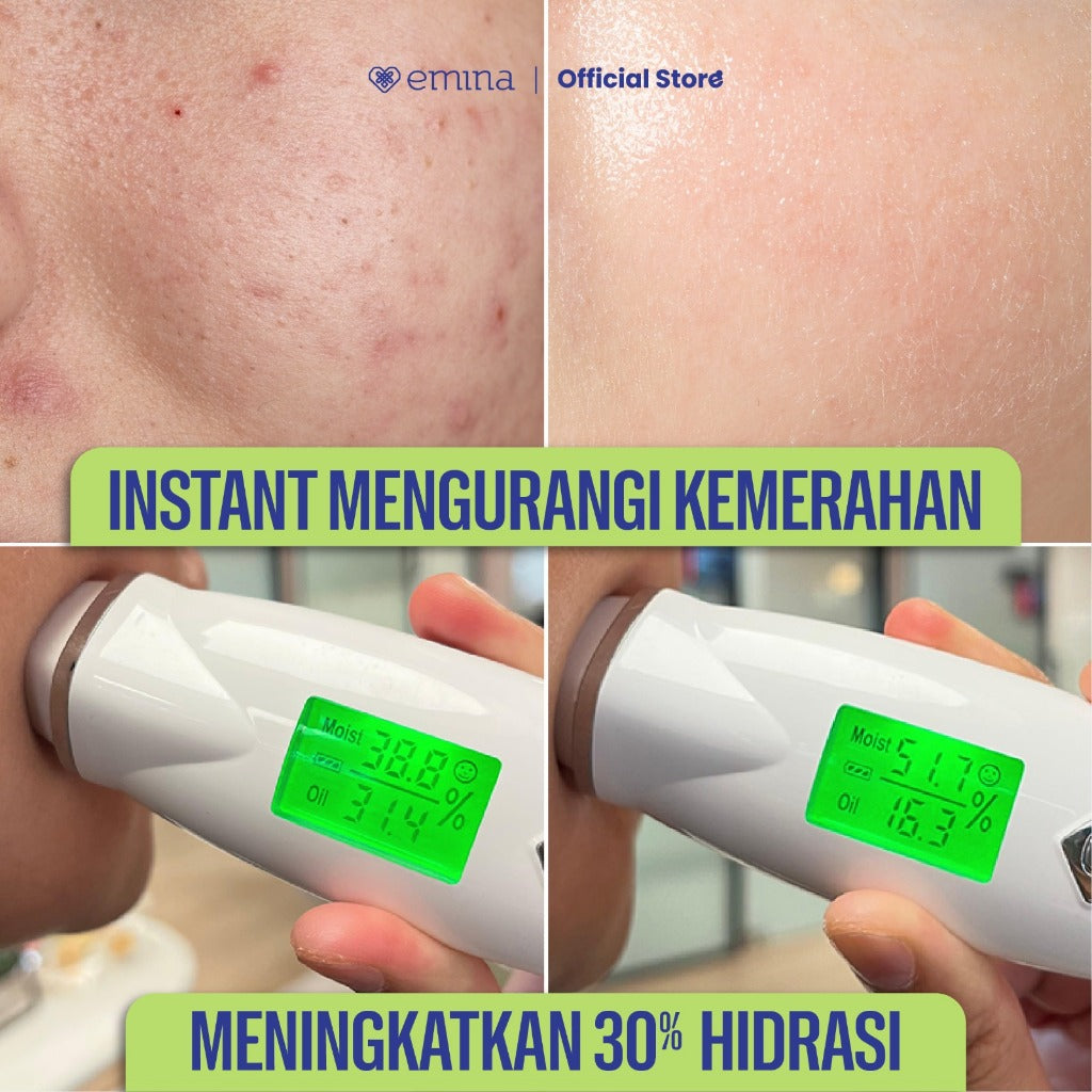 NEW! Emina Cica Triacid Acne Clear Water Gel 30g - Moisturizer Pelembab Jerawat, Meredakan Jerawat, Mengontrol Sebum Wajah, Soothing, untuk Kulit Berminyak/Sensitive, Pelembab Seringan Air | Mengandung Salicylic Acid, Succinic Acid, Lactid acid, Cica