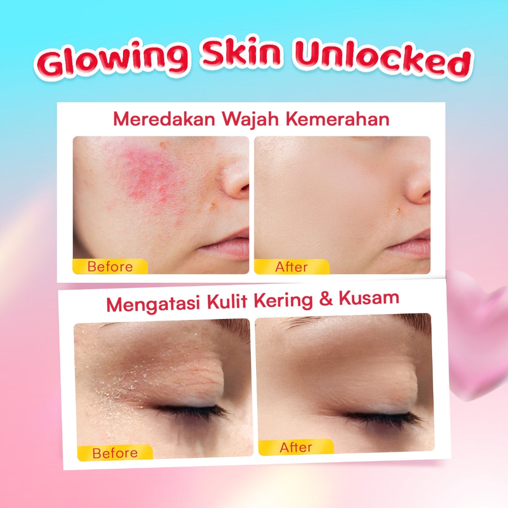 [NEW LAUNCH] Glowsophy Cica Glow Snail Moisturizer - Melembabkan kulit wajah, slimy-textured moisturizer, Membantu menenangkan kulit wajah , Mencerahkan wajah