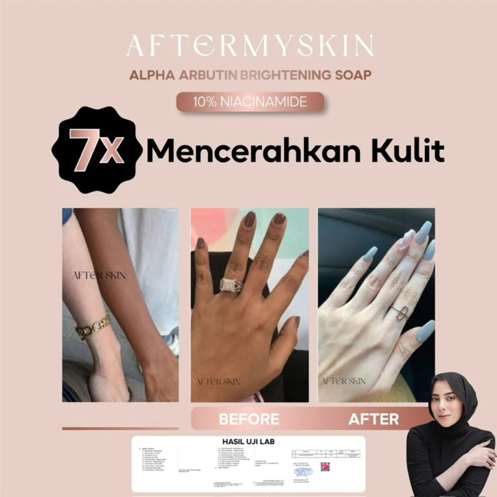 AFTERMYSKIN - Afterskin Alpha Arbutin Brightening Soap Isi 2pcs