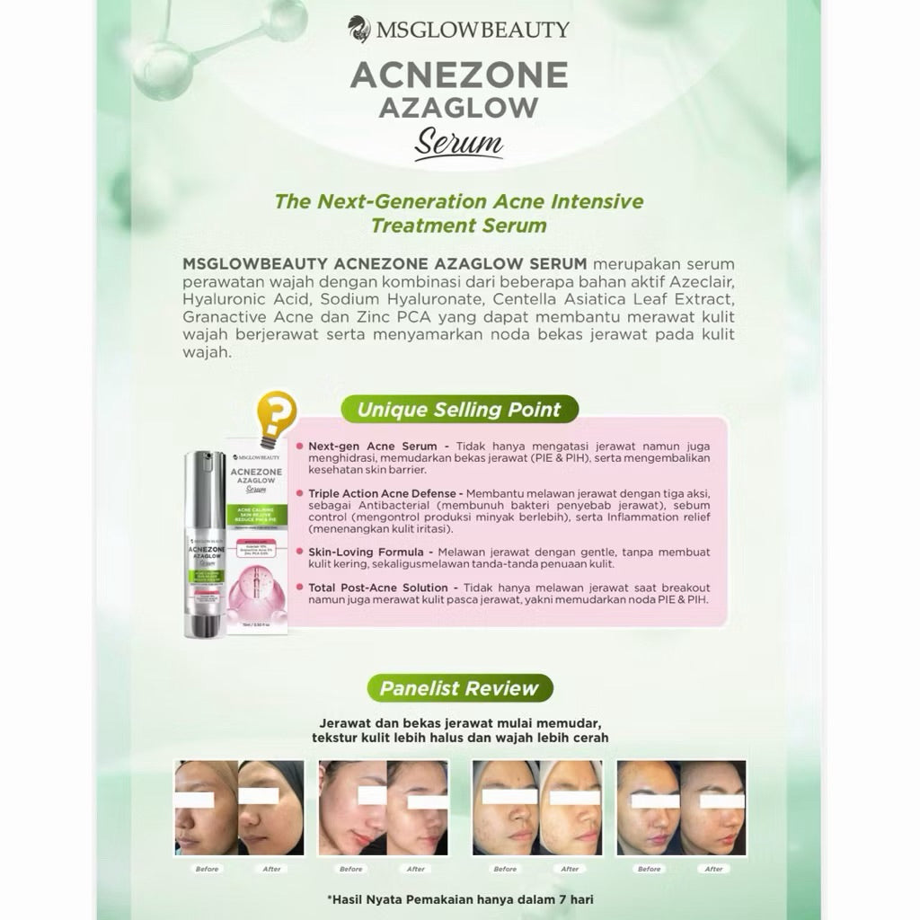 MS glow ACNEZONE AZAGLOW SERUM JERAWAT
