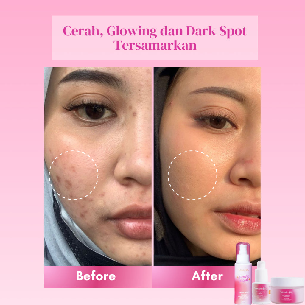 Bundling Wonderish - Paket Triple Glow Booster Series Brightening (Serum, Facial Wash, Moisturizer) by Irish Bella