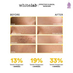Whitelab 2 pcs Set Toner + Serum
