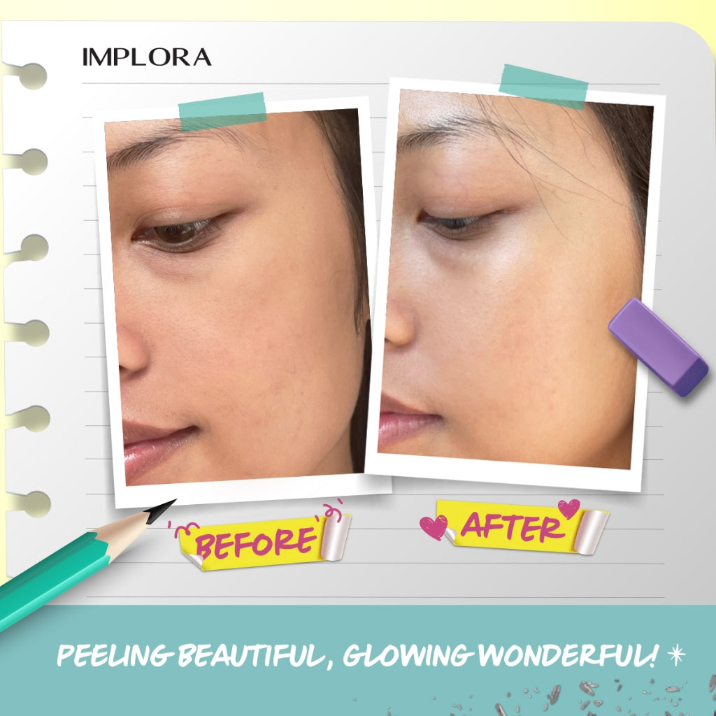 Implora How Does It Peel - Peeling Gel | Exfoliating | AHA BHA Aloe vera