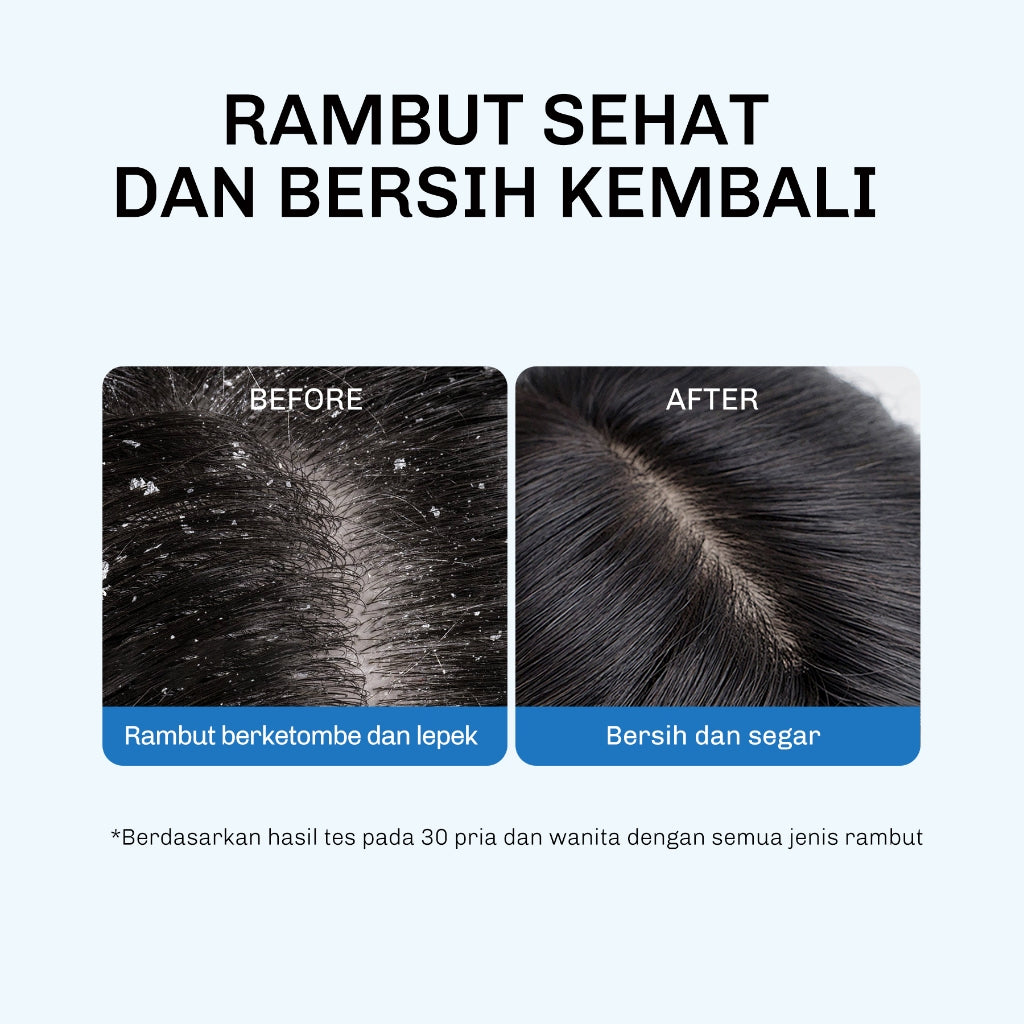 Lavojoy Shampoo Series | dengan Salicylic Acid | Membersihkan Kulit Kepala Dan Rambut | Mengurangi Gatal Kulit Kepala | Mengurangi Minyak Rambut | Membuat Rambut Lembut dan Berkilau
