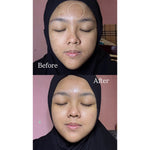 Ultimate Glow Hydration Set I Bundling Peeling Serum + Moisturizer Barrier I Combo Glowing