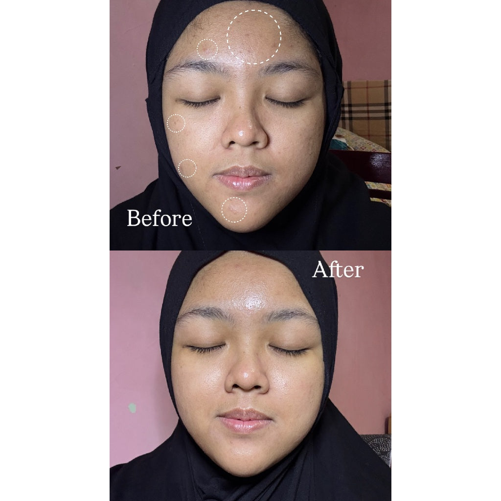 Ultimate Glow Hydration Set I Bundling Peeling Serum + Moisturizer Barrier I Combo Glowing