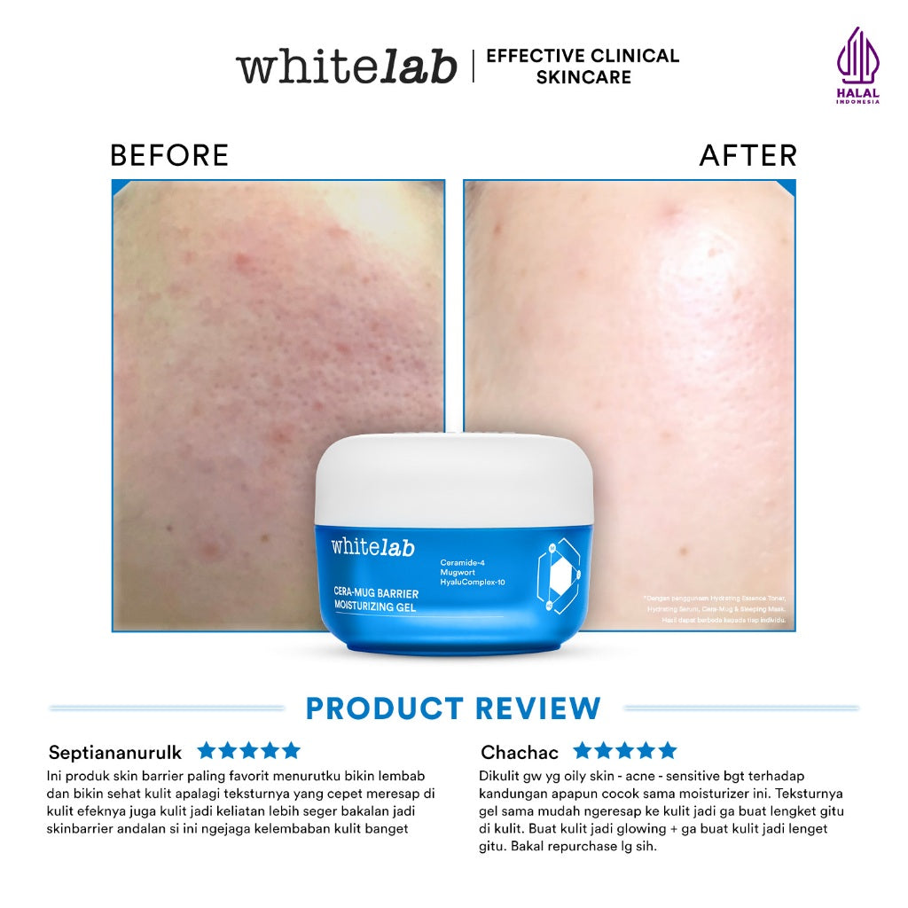 Whitelab Cera-Mug Moisturizer Gel untuk Skin Barrier - Pelembap Kulit Wajah Kering Siang Malam Cera-mug dengan Hyaluronic, Ceramide