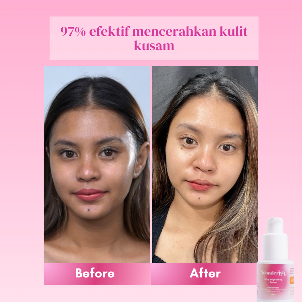 Wonderish Serum - Brightening Silky Repair Your Skin By Irish Bella