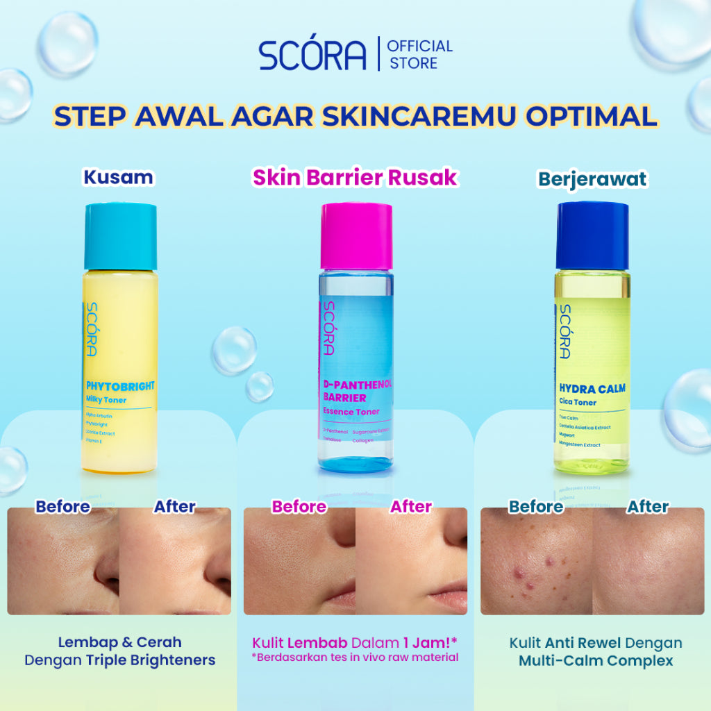 [NEW LAUNCH] SCORA Toner Series 80ml - Hydra Calm Cica Toner, Phytobright Milky Toner, D–Panthenol Barrier Essence