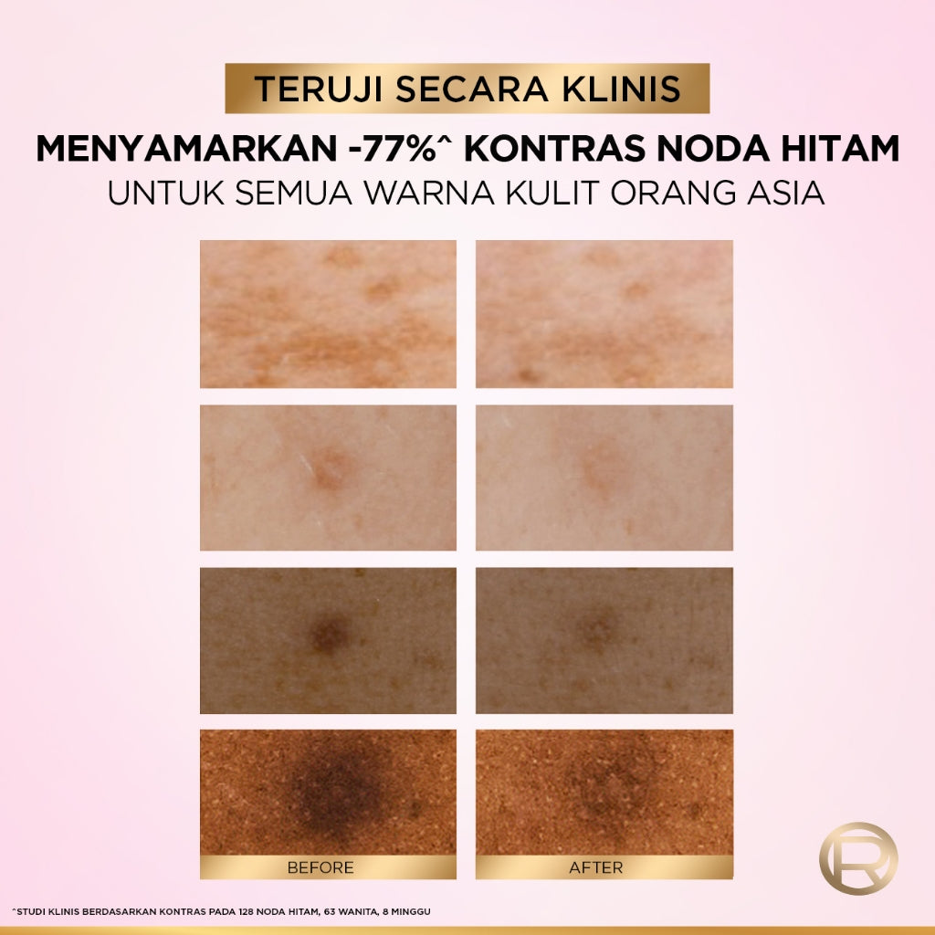 L'Oreal Paris Glycolic Bright 8% [MELASYL + GLYCOLIC + NIACINAMIDE] ANTI-DARK SPOT BRIGHTENING SERUM (Mencerahkan kulit & Menyamarkan Noda hitam bahkan bekas jerawat sekalipun)  Kulit Kusam, Noda Hitam, Bekas Jerawat, Eksfoliasi  Brightening serum