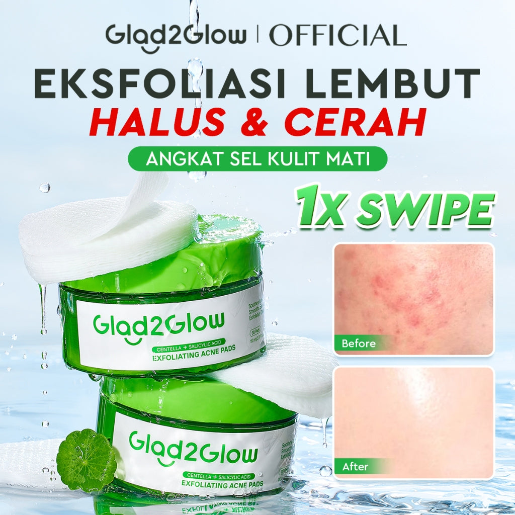 Glad2Glow Centella Salicylic Acid Exfoliating Acne Toner Pads Gentle Eksfoliasi Kulit Jerawat Kulit Sensitif (30 pads) Centella Pads Lactic Acid Malic AHA BHA Peeling Serum Acne Spot Serum Cica Acne Clear Pad Treatment Jerawat exfoliasi wajah obat jerawat