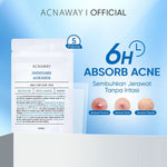 ACNAWAY Infinity Acne Patch – Acne Patch Ukuran Besar 6x2.5cm untuk Jerawat | Breathable, Tipis & Sweatproof | Plester Jerawat Tempel dengan Salicylic Acid + Centella + Mugwort