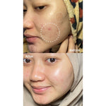 Ultimate Glow Hydration Set I Bundling Peeling Serum + Moisturizer Barrier I Combo Glowing