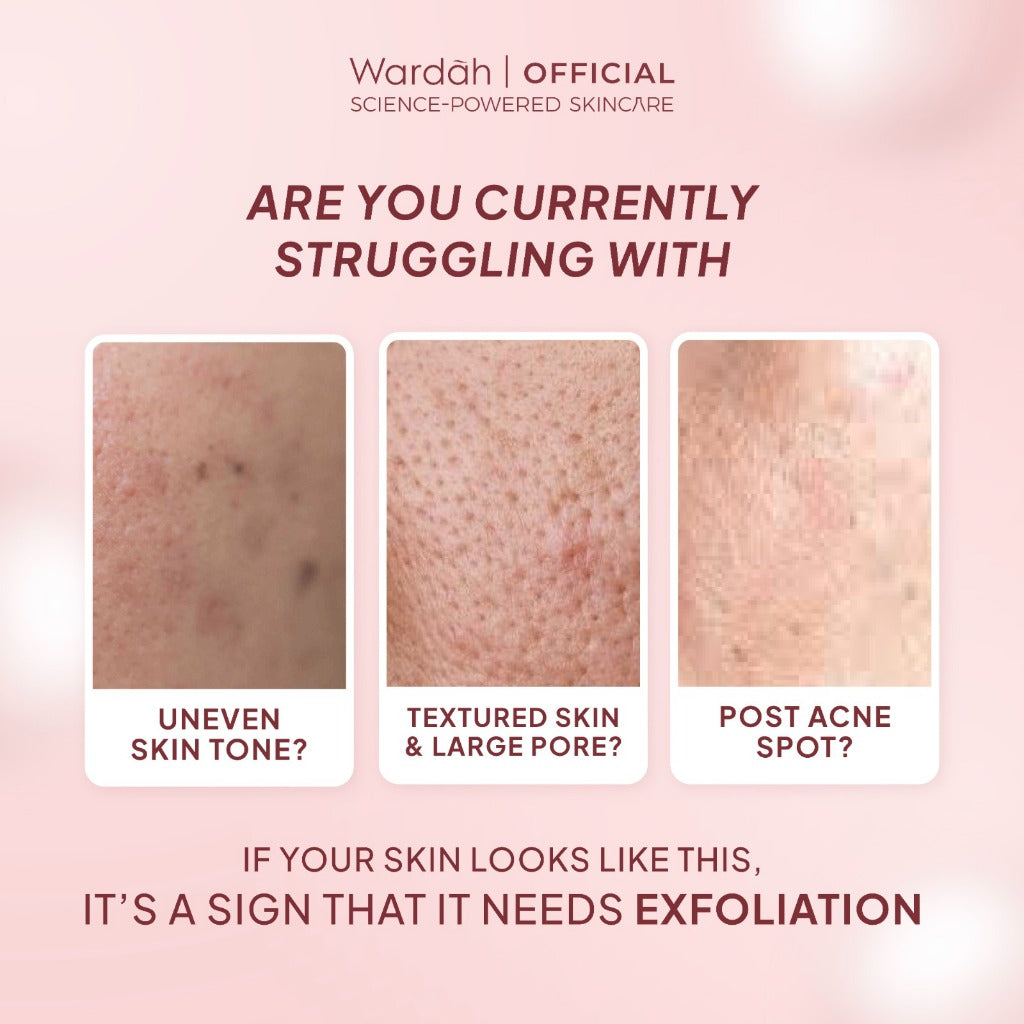 NEW! Wardah 3% AHA-PHA Phyto-Enzyme Exfoliating & Clarifying Toner 100 ml-Mengangkat Sel Kulit Mati, Mencerahkan dan Melembukan Kulit Tanpa Sensasi Cekit-Cekit dan Tanpa Sensasi Terbakar - Skincare