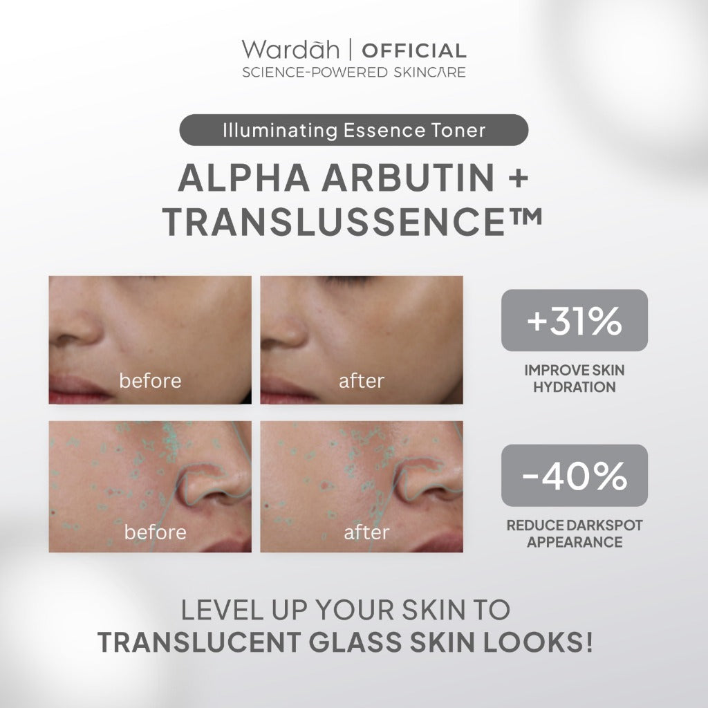 NEW! Wardah Alpha Arbutin Translussence Illuminating Essence Toner 50 ml Mencerahkan Kulit Menghilangkan Dark Spot Menghidrasi Kulit Ceramide dan Melembutkan Tekstur Wajah Untuk Semua Jenis Kulit - Toner Badan - Skincare