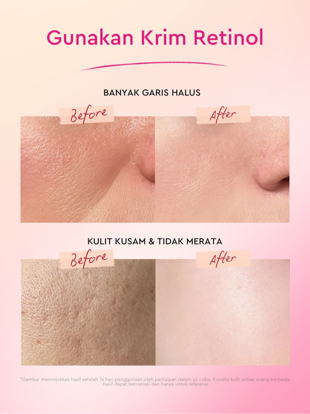 [Cocok Untuk Pemula] Glad2Glow Cerah Retinol Bundle 4in1-Brightening Moisturizer+Serum+Cleanser+toner Retinol  skincare paket pembersih perawatan kulit warna kulit pelembab wajah all in 1g2glow official store