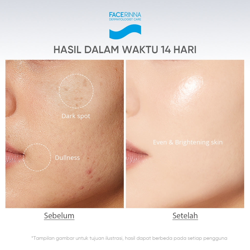 Facerinna Niacinamide Brightening Serum Sunscreen 30ml SPF 50 PA++++ | Proteksi UV Daily Physical